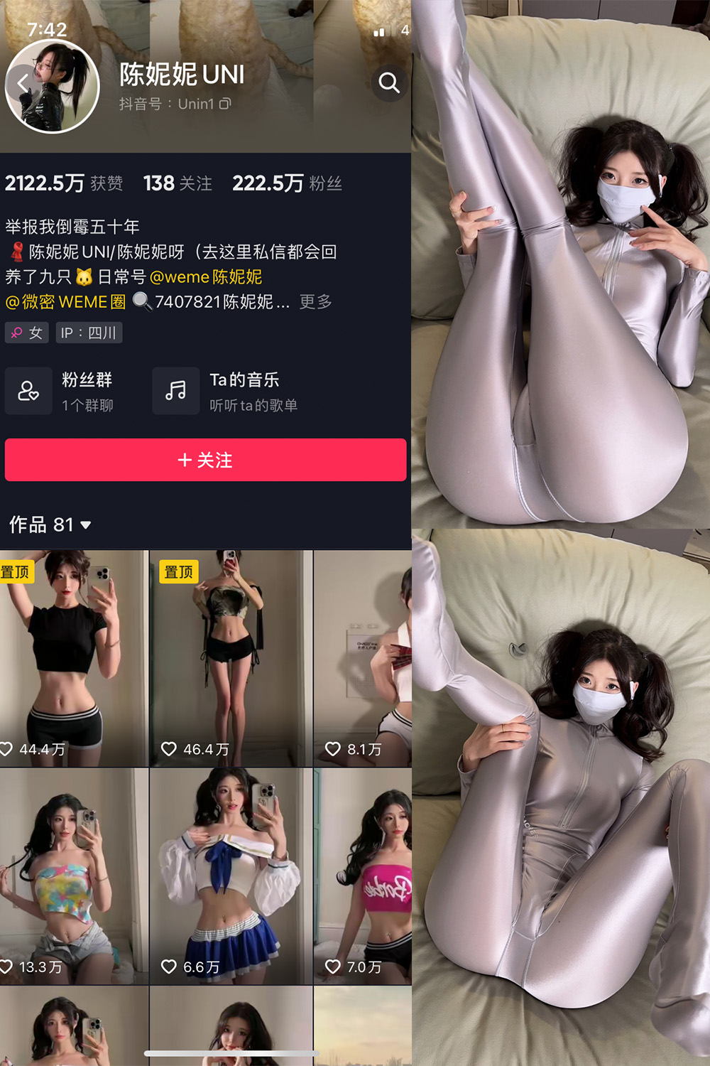 抖音 陈妮腻UNI 微密圈 NO.005期 【21P】