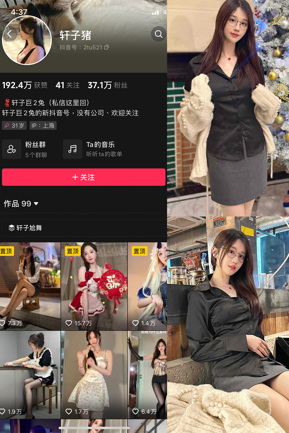 抖音 轩子巨二兔 微密圈 NO.016期 【10P】