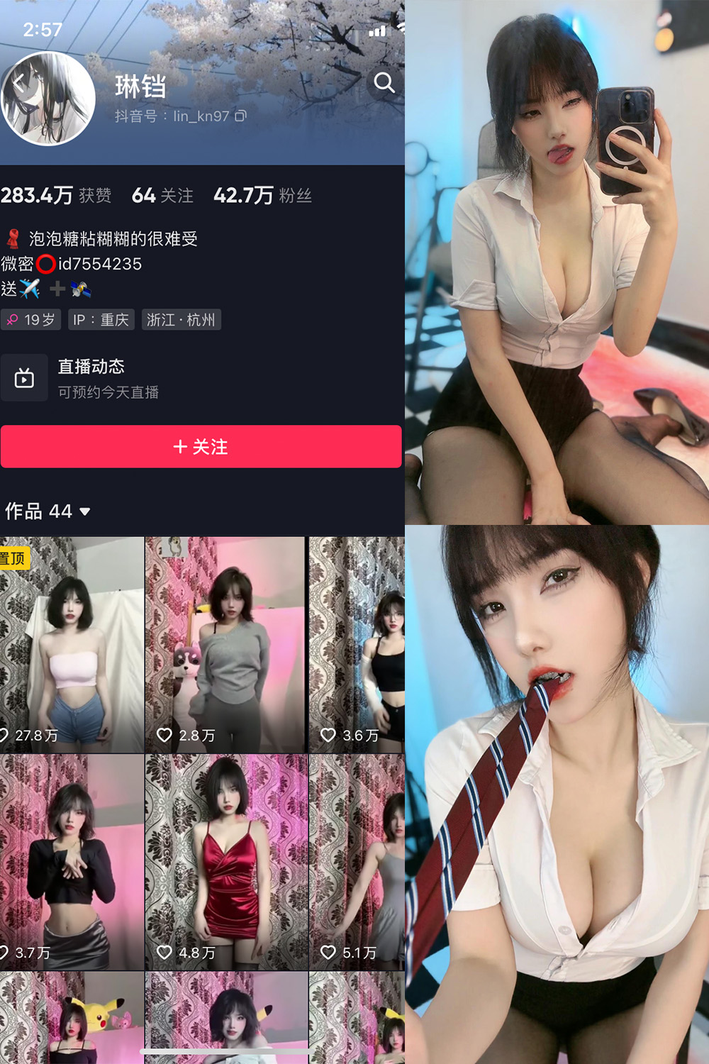 抖音 琳铛 微密圈 NO.041期 【11P】