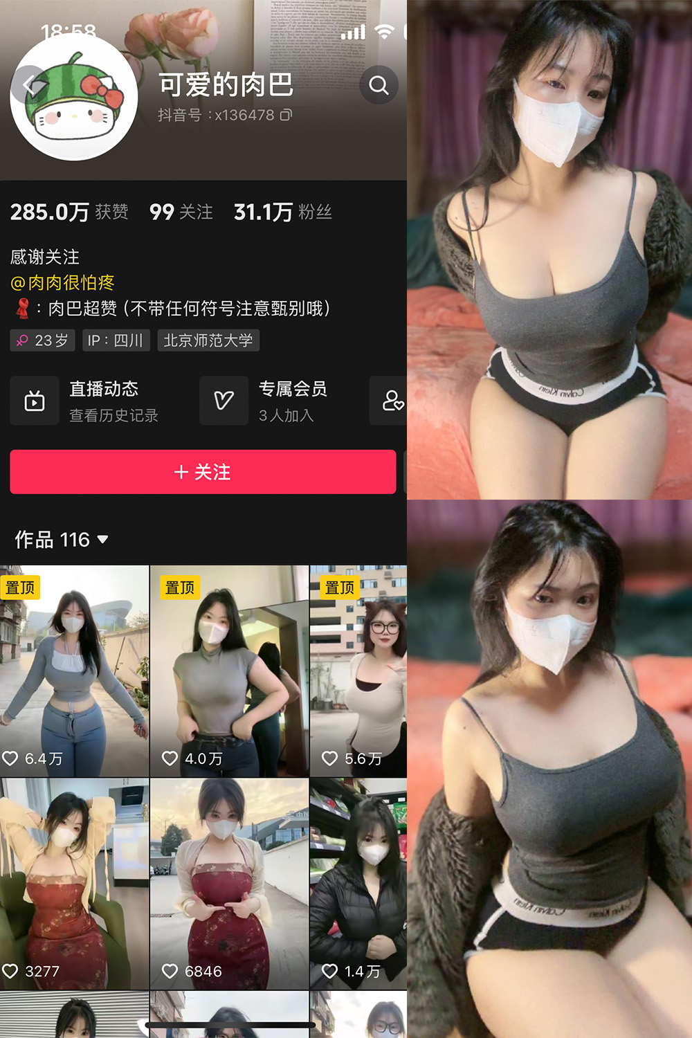 抖音 可爱的肉巴 微密圈 NO.011期 【14P6V】