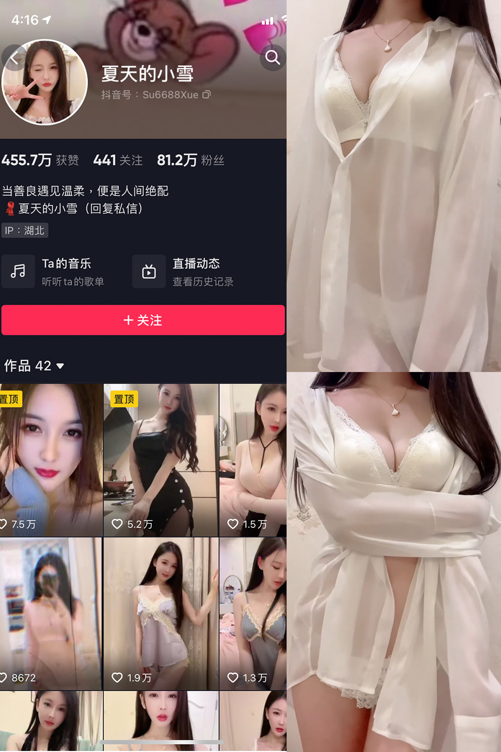 抖音 夏天的小雪 微密圈 嘉宾专享 NO.011期 【4P2V】