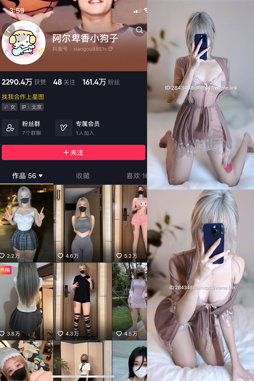 抖音 阿尔卑香小狗子 微密圈 NO.016期 【33P】