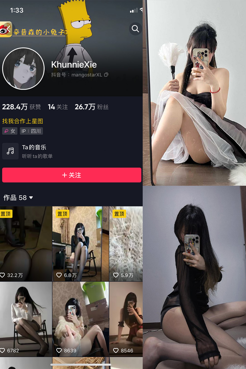 抖音 辛普森的兔子 微密圈 NO.002期 【34P8V】