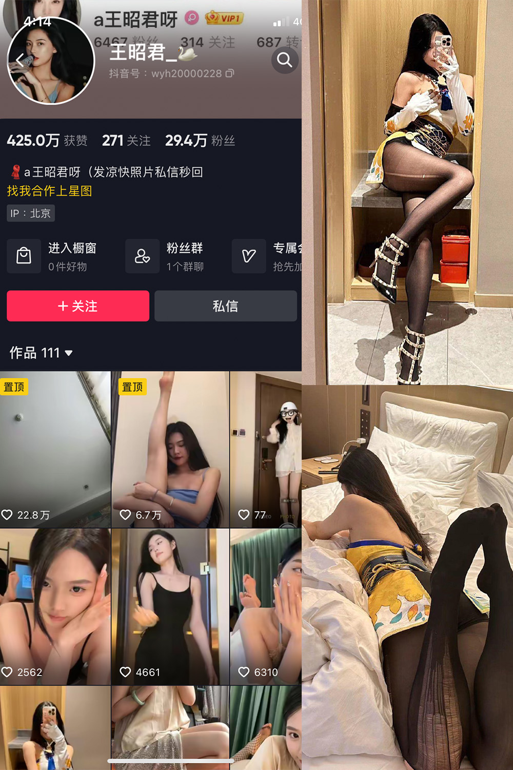 抖音 王昭君 微密圈 NO.002期 【14P15V】