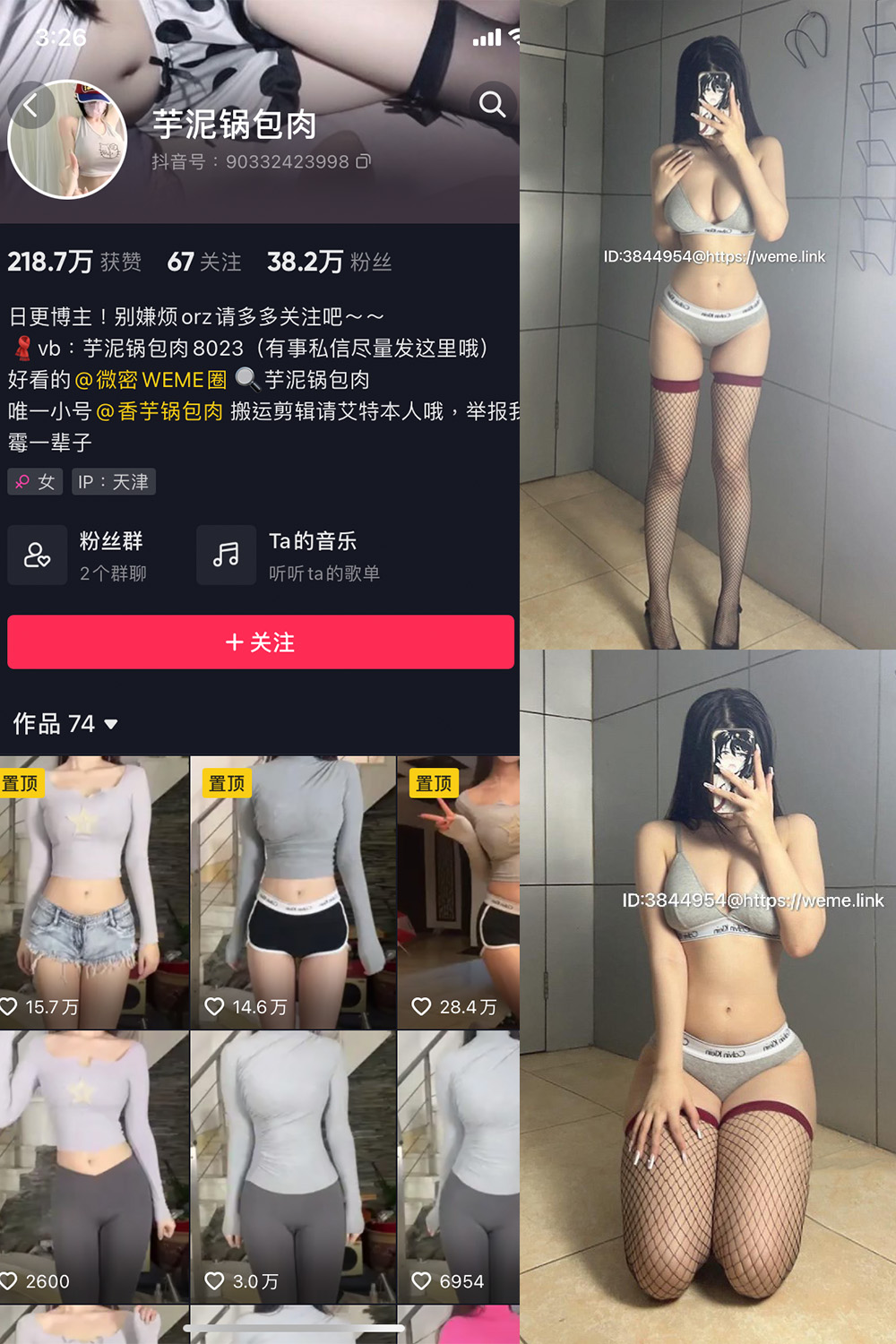 抖音 芋泥锅包肉 微密圈 NO.005期 【16P9V】